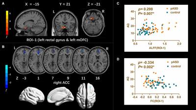 Altered intrinsic brain activity and connectivity in unaffected parents of individuals with autism spectrum disorder: a resting-state fMRI study